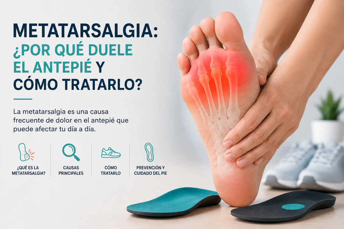 Ilustración anatómica del antepié mostrando las cabezas metatarsales y las zonas de hiperpresión en la metatarsalgia