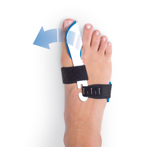 VALGUS CONTROL CORRECTOR NOCTURNO DE HALLUX VALGUS - HV200