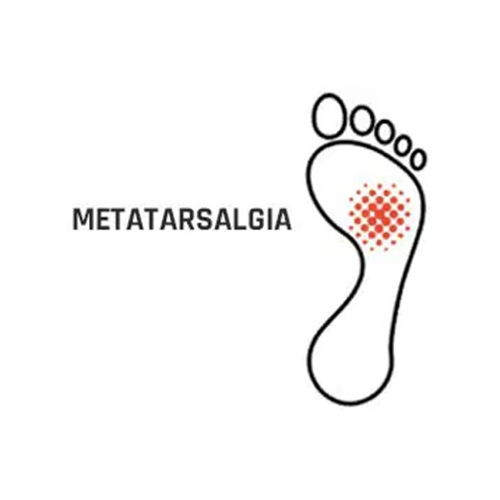 Plantilla de Descarga Metatarsal | Dolor en Metatarso